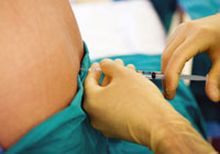I'm a reformed epidural user