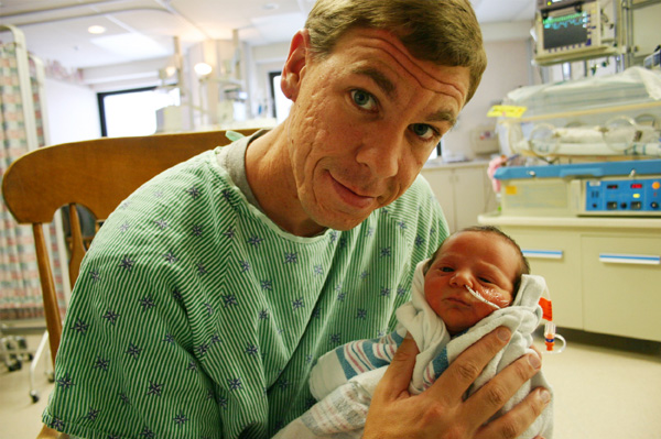 Preemie in NCIU