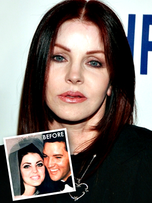 Priscilla Presley - bad plastic surgery