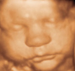 3D bonding with baby