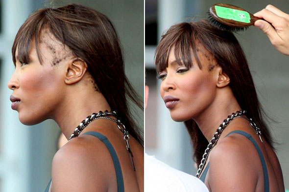 Naomi Campbell's hair loss