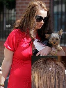 Britney Spears' hair loss