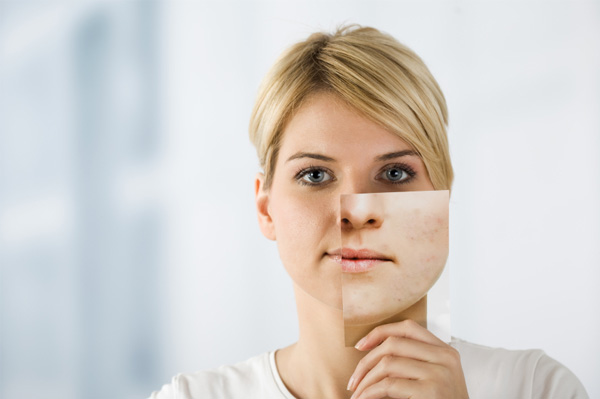 Woman with problem skin