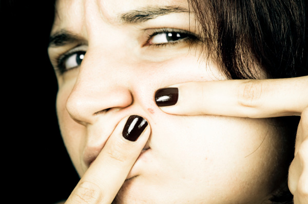 Woman popping pimple