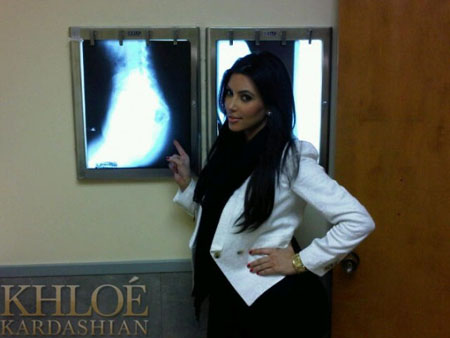 Kim Kardashian butt xray