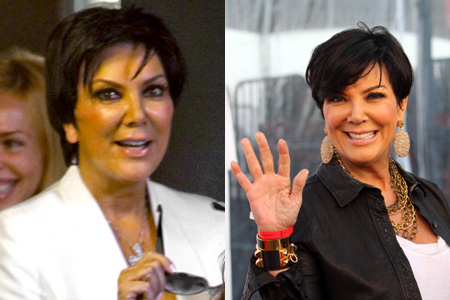 Kris Jenner Plastic Surgery on Kris Jenner Before And After Facelift