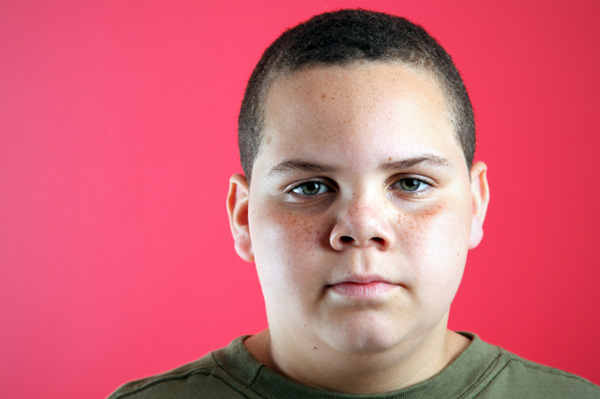 Obese child