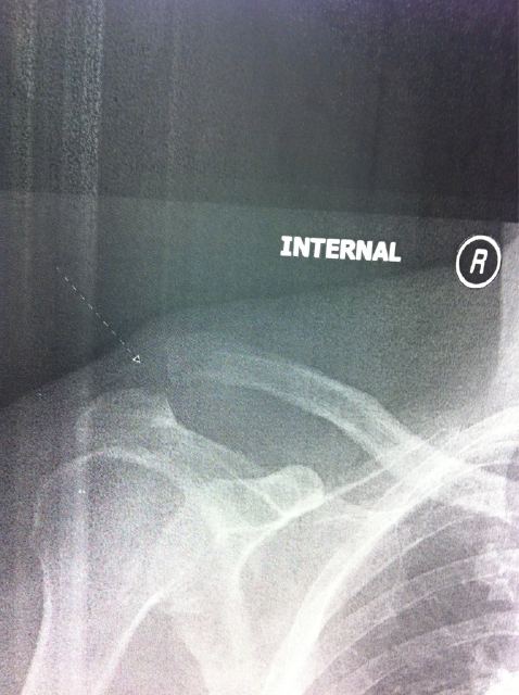 Drew Carey x-ray