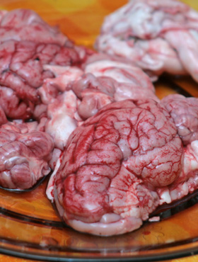Brains