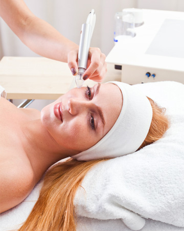 skin microdermabrasion