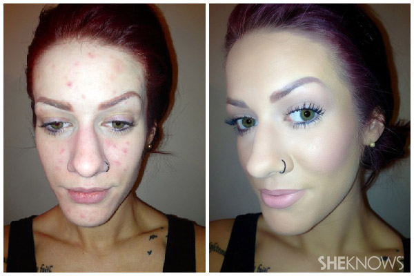 Skin before and after acne tutorial