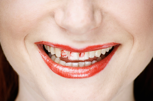 [Image: woman-lipstick-teeth.jpg]