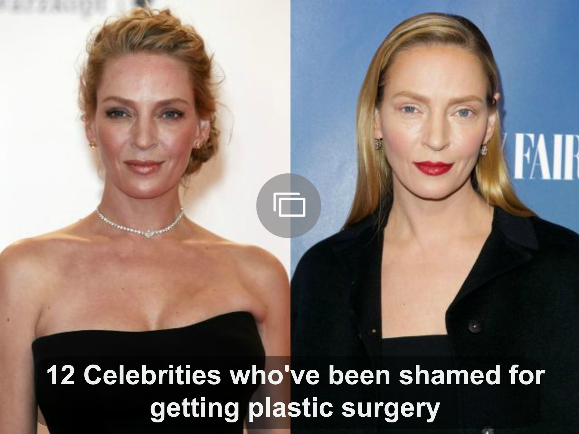 Celebrities who've been shamed for plastic surgery