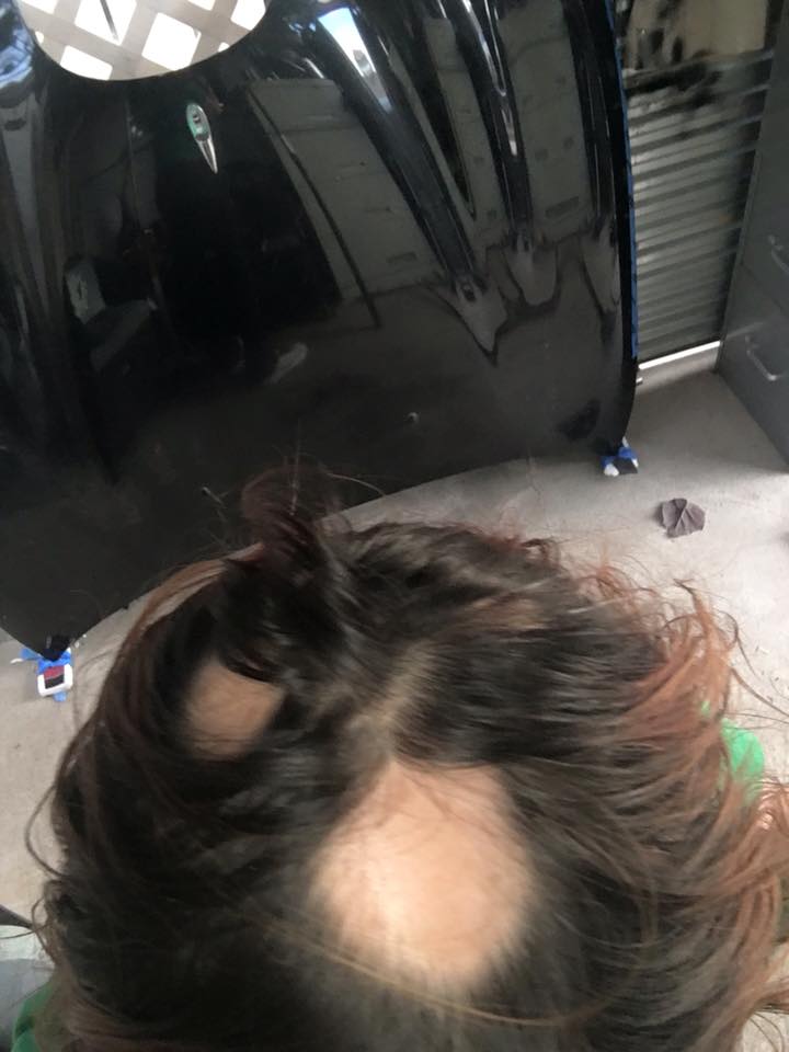 Dozens of women claim Wen products made their hair fall out