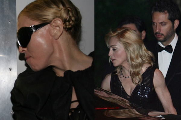 Madonna before and after