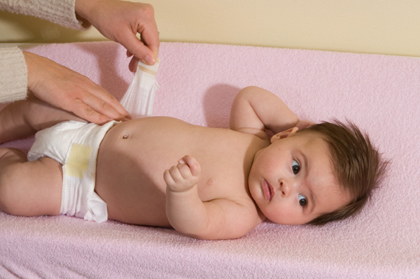 Baby girl getting diaper change. Diaper rash can appear in many painful 