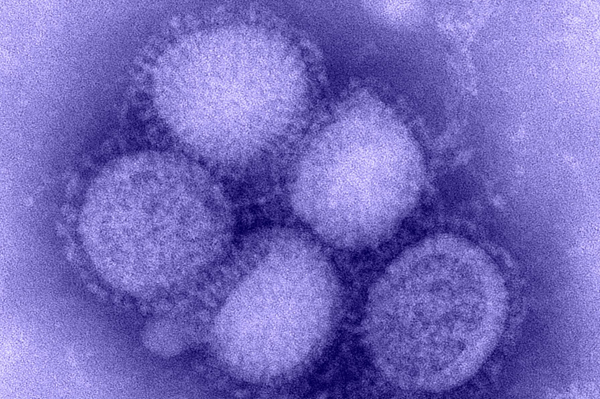 H1N1