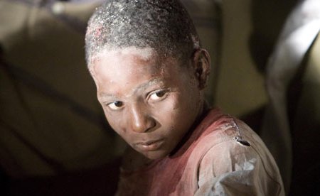 A victim of the Haiti earthquake, one of many than need US aid