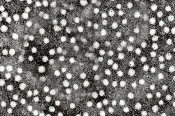 Hepatitis B