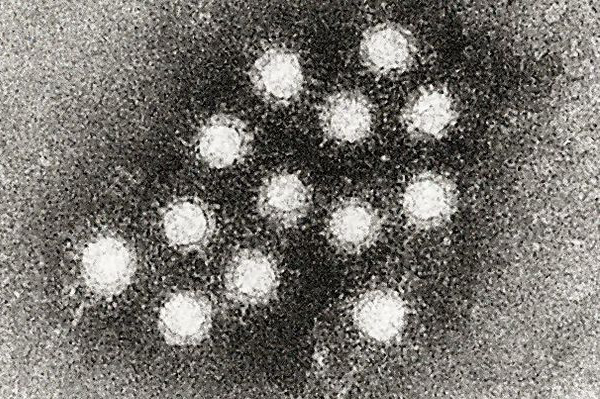 Hepatitis A Virus
