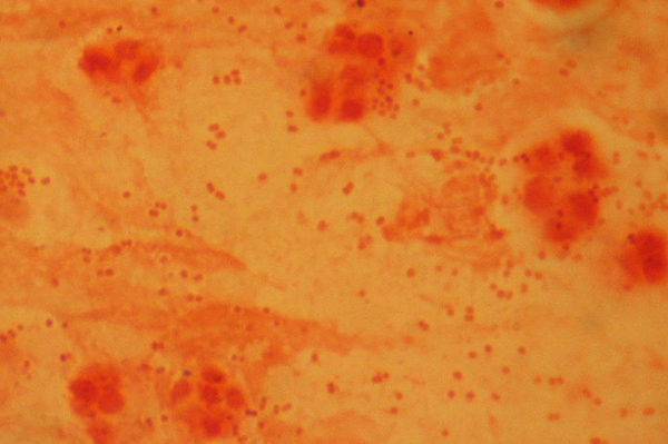 Hib Bacteria