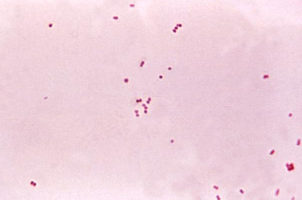 Meningococcal Slide