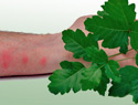 How to treat and avoid poison ivy, poison oak and poison sumac