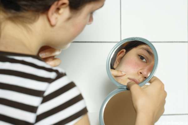 Rosacea