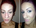 The 8-step guide to clear skin