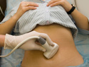 What to expect from the 20-week ultrasound