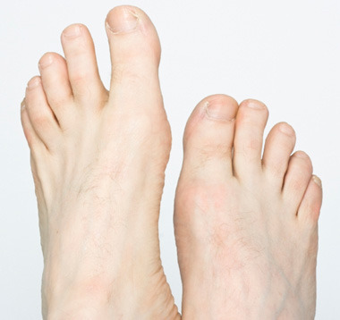 Toenail biter