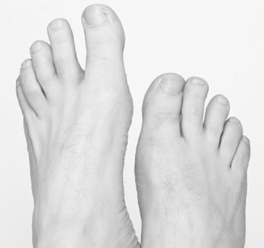 Toenail biter