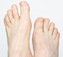 Toenail biter